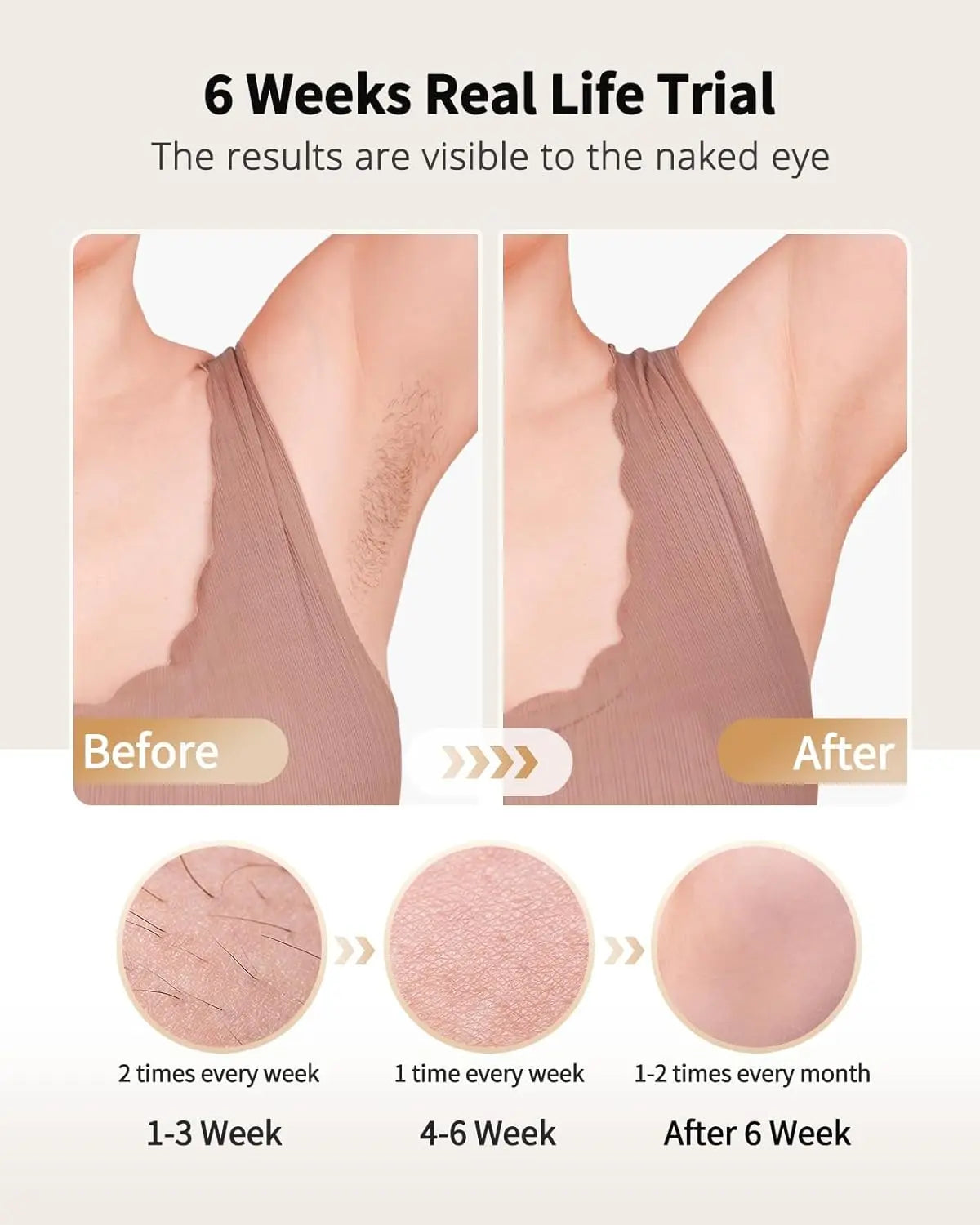 LYSMOSKI IPL Hair Removal Device With Ice Cooling Function